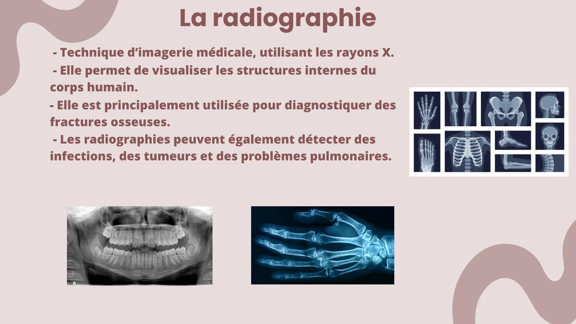 La radiographie
- Technique d'imagerie médicale, utilisant les rayons X.
- Elle permet de visualiser les structures internes du
corps humain