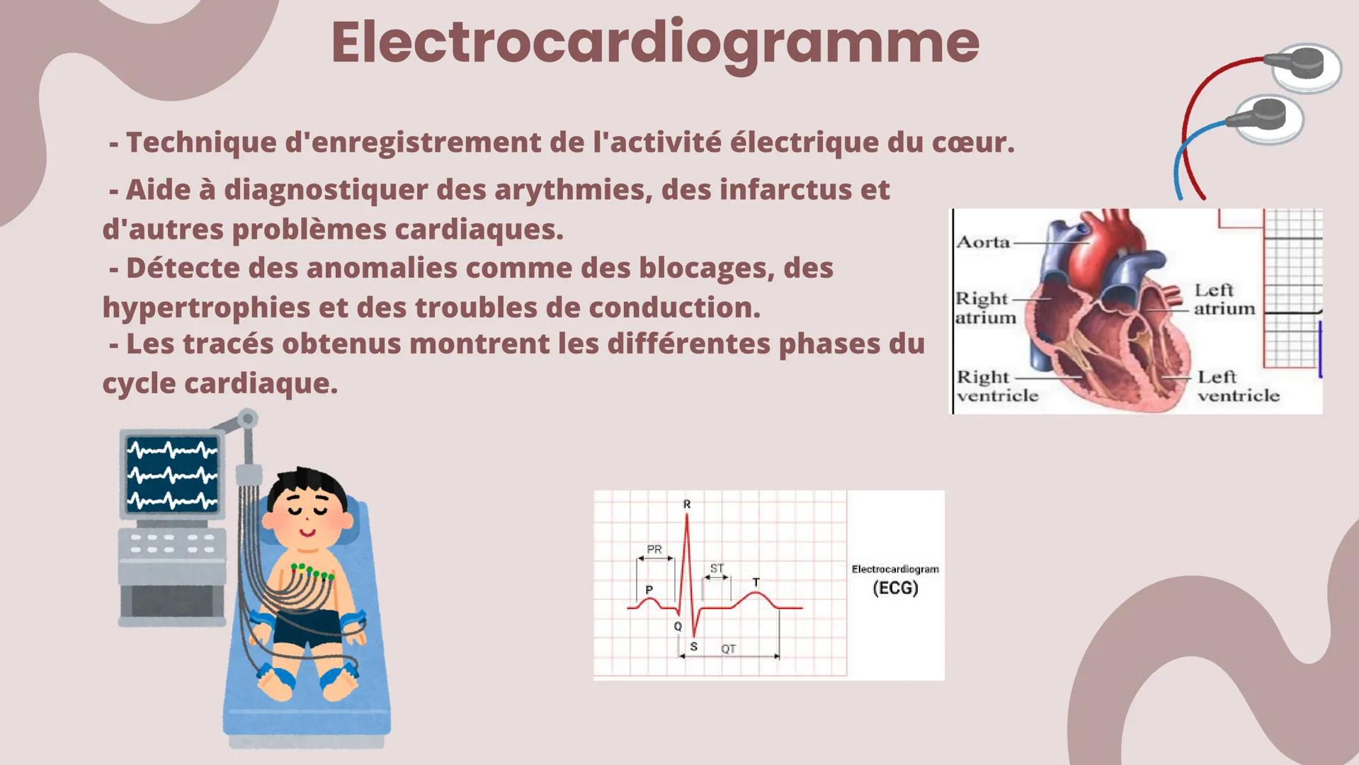 La radiographie
- Technique d'imagerie médicale, utilisant les rayons X.
- Elle permet de visualiser les structures internes du
corps humain