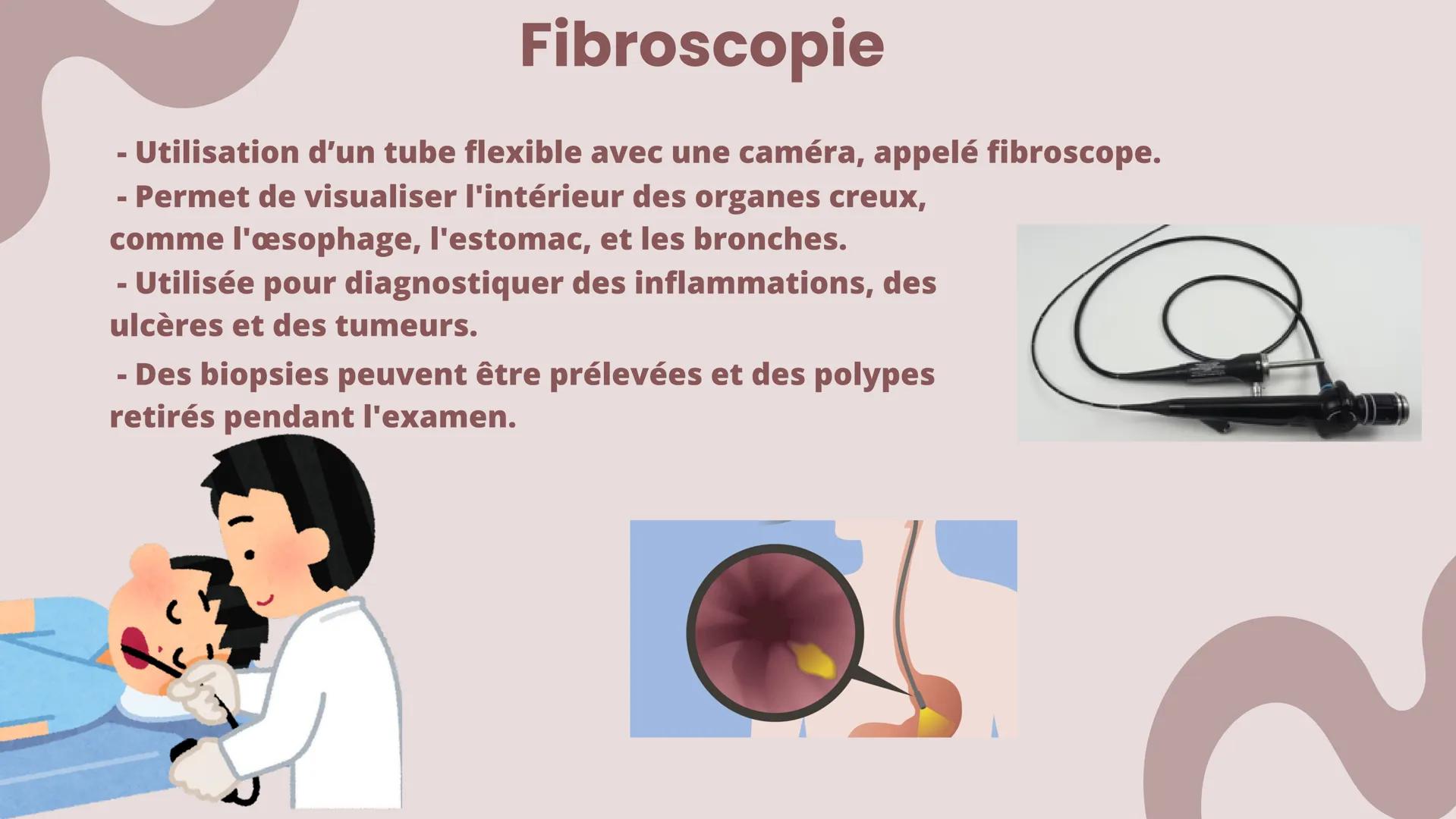 La radiographie
- Technique d'imagerie médicale, utilisant les rayons X.
- Elle permet de visualiser les structures internes du
corps humain