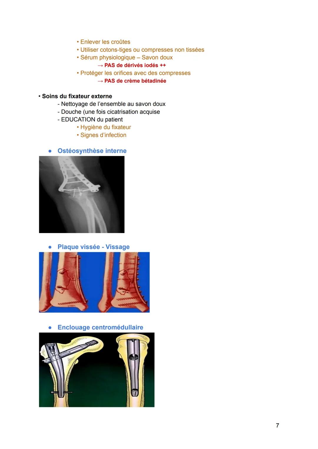 # Processus traumatiques de l'appareil locomoteur :
Traitement - Immobilisation
* Prise en charge initiale
* Contrôler la douleur