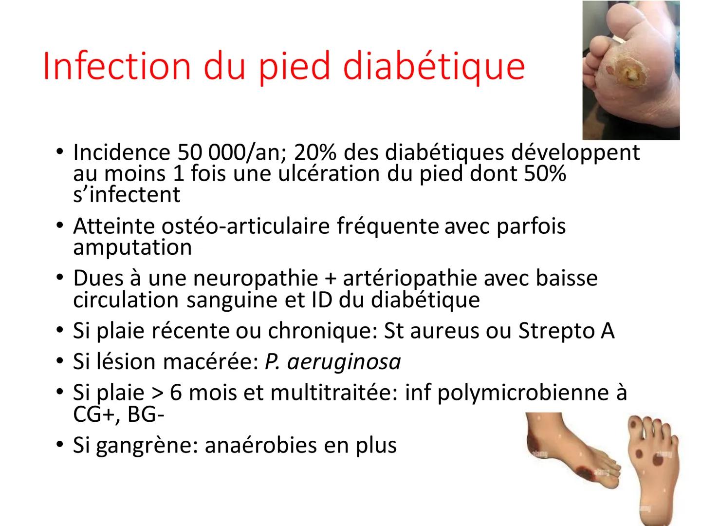 Infections
Ostéoarticulaires
Ostéite et ostéomyélite Définition et épidémiologie
• Une infection ostéo-articulaire est une infection à
bacté