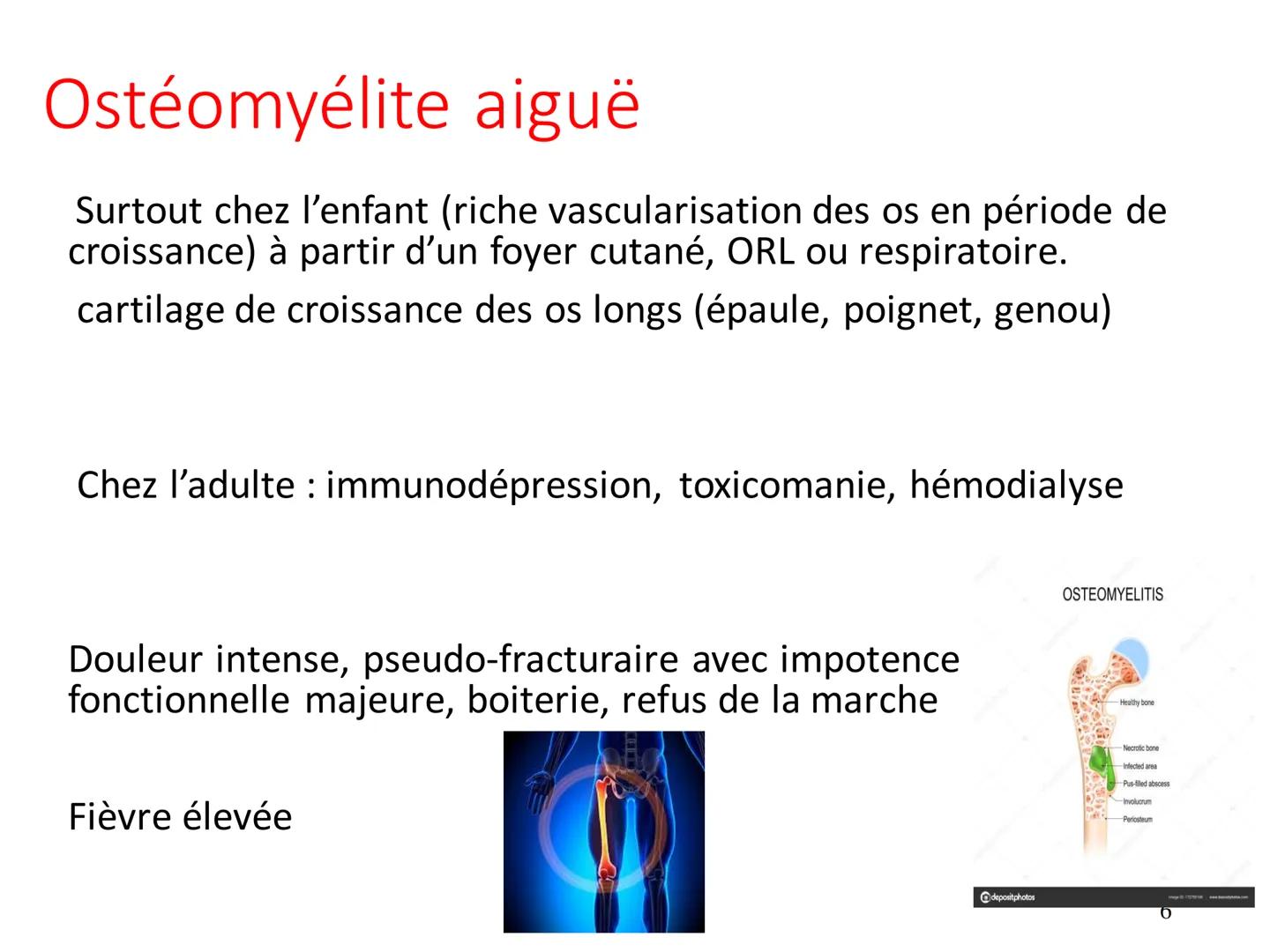 Infections
Ostéoarticulaires
Ostéite et ostéomyélite Définition et épidémiologie
• Une infection ostéo-articulaire est une infection à
bacté